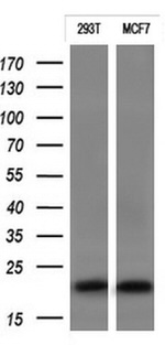 CTAG1B Antibody in Western Blot (WB)