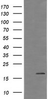 CTAG1B Antibody in Western Blot (WB)