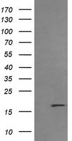 CTAG1B Antibody in Western Blot (WB)