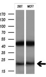 CTAG1B Antibody in Western Blot (WB)
