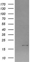 CTAG1B Antibody in Western Blot (WB)