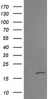 CTAG1B Antibody in Western Blot (WB)