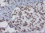 CTDSP1 Antibody in Immunohistochemistry (Paraffin) (IHC (P))