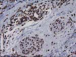 CTDSP1 Antibody in Immunohistochemistry (Paraffin) (IHC (P))