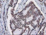 CTDSP1 Antibody in Immunohistochemistry (Paraffin) (IHC (P))