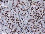 CTDSP1 Antibody in Immunohistochemistry (Paraffin) (IHC (P))