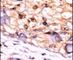 CTDSP1 Antibody in Immunohistochemistry (IHC)
