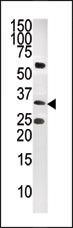 CTDSP1 Antibody in Western Blot (WB)