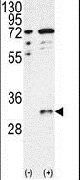 CTDSP1 Antibody in Western Blot (WB)