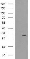 CTDSP1 Antibody in Western Blot (WB)