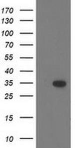 CTDSP1 Antibody in Western Blot (WB)