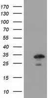 CTDSP1 Antibody in Western Blot (WB)