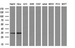 CTDSP1 Antibody in Western Blot (WB)