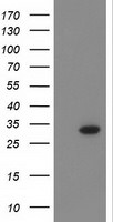 CTDSP1 Antibody in Western Blot (WB)
