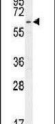 CTDSPL2 Antibody in Western Blot (WB)