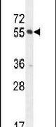 CTDSPL2 Antibody in Western Blot (WB)