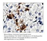 CTGF Polyclonal Antibody