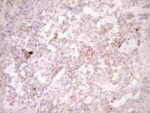 CTGF Antibody in Immunohistochemistry (Paraffin) (IHC (P))