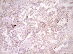 CTGF Antibody in Immunohistochemistry (Paraffin) (IHC (P))