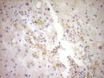 CTGF Antibody in Immunohistochemistry (Paraffin) (IHC (P))