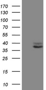 CTGF Antibody in Western Blot (WB)