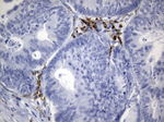 CTLA4 Antibody in Immunohistochemistry (Paraffin) (IHC (P))