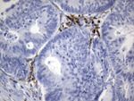 CTLA4 Antibody in Immunohistochemistry (Paraffin) (IHC (P))