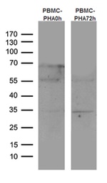 CTLA4 Antibody in Western Blot (WB)