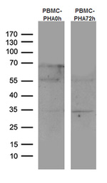 CTLA4 Antibody in Western Blot (WB)