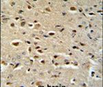 Catenin alpha-1 Antibody in Immunohistochemistry (IHC)