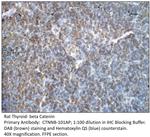 beta Catenin Antibody in Immunohistochemistry (IHC)