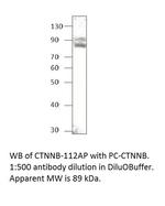 beta Catenin Polyclonal Antibody
