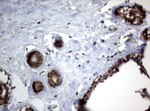 CTNND1 Antibody in Immunohistochemistry (Paraffin) (IHC (P))