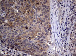 CTNND1 Antibody in Immunohistochemistry (Paraffin) (IHC (P))