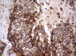 CTNND1 Antibody in Immunohistochemistry (Paraffin) (IHC (P))