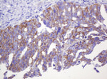 CTNND1 Antibody in Immunohistochemistry (Paraffin) (IHC (P))