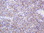 CTNND1 Antibody in Immunohistochemistry (Paraffin) (IHC (P))