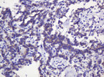 CTNND1 Antibody in Immunohistochemistry (Paraffin) (IHC (P))