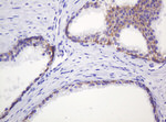 CTNND1 Antibody in Immunohistochemistry (Paraffin) (IHC (P))