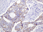 CTNND1 Antibody in Immunohistochemistry (Paraffin) (IHC (P))