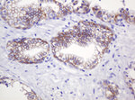 CTNND1 Antibody in Immunohistochemistry (Paraffin) (IHC (P))