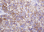 CTNND1 Antibody in Immunohistochemistry (Paraffin) (IHC (P))