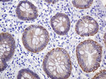 CTNND1 Antibody in Immunohistochemistry (Paraffin) (IHC (P))