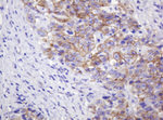 CTNND1 Antibody in Immunohistochemistry (Paraffin) (IHC (P))