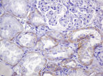CTNND1 Antibody in Immunohistochemistry (Paraffin) (IHC (P))