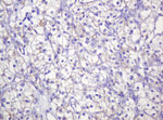 CTNND1 Antibody in Immunohistochemistry (Paraffin) (IHC (P))
