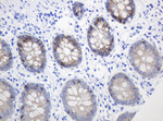 CTNND1 Antibody in Immunohistochemistry (Paraffin) (IHC (P))