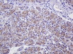 CTNND1 Antibody in Immunohistochemistry (Paraffin) (IHC (P))