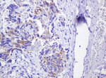 CTNND1 Antibody in Immunohistochemistry (Paraffin) (IHC (P))