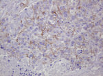 CTNND1 Antibody in Immunohistochemistry (Paraffin) (IHC (P))